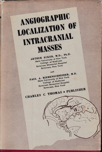Angiographic Localization of Intracanial Masses