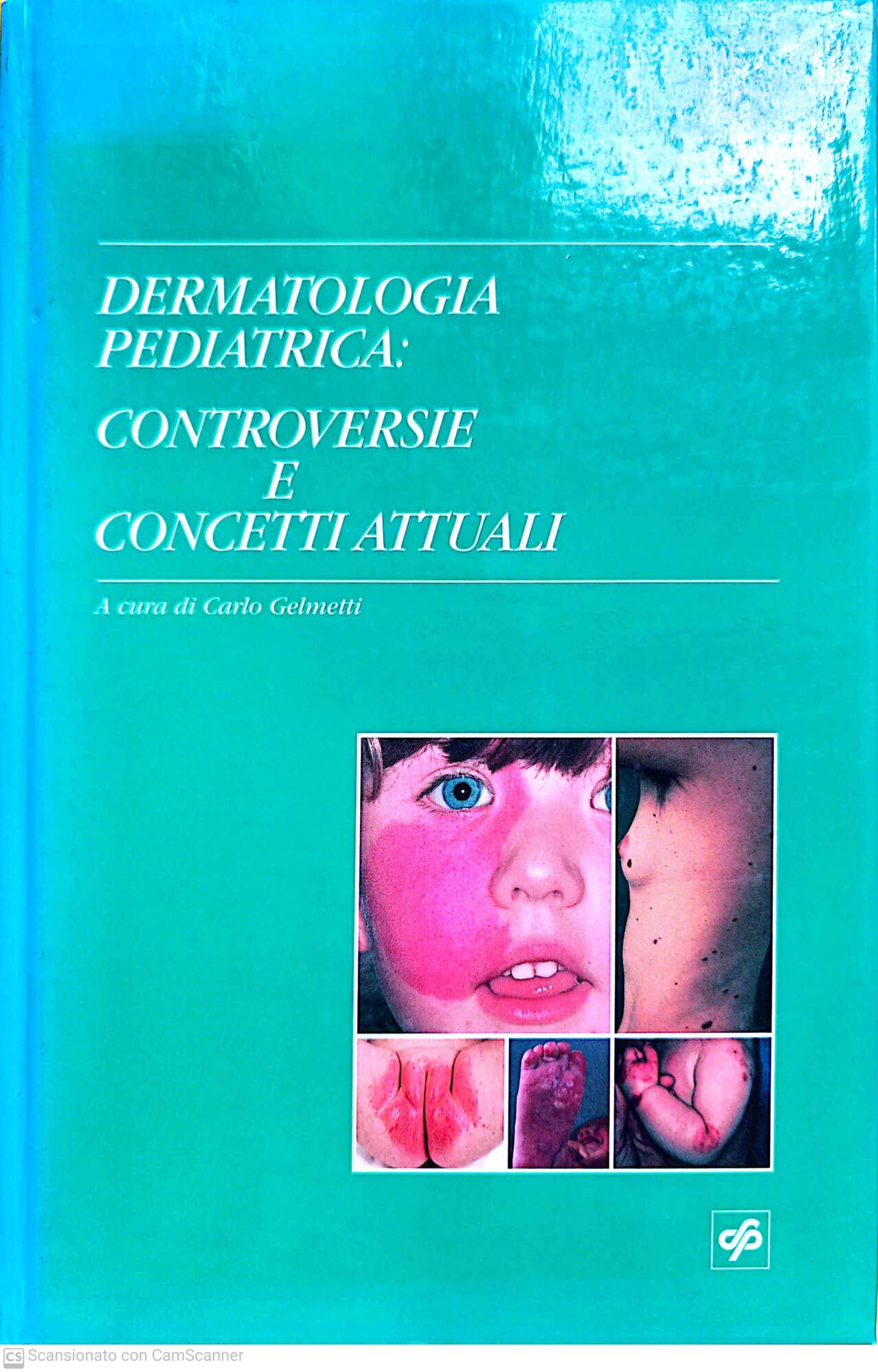 Dermatologia pediatrica: controversie e concetti attuali