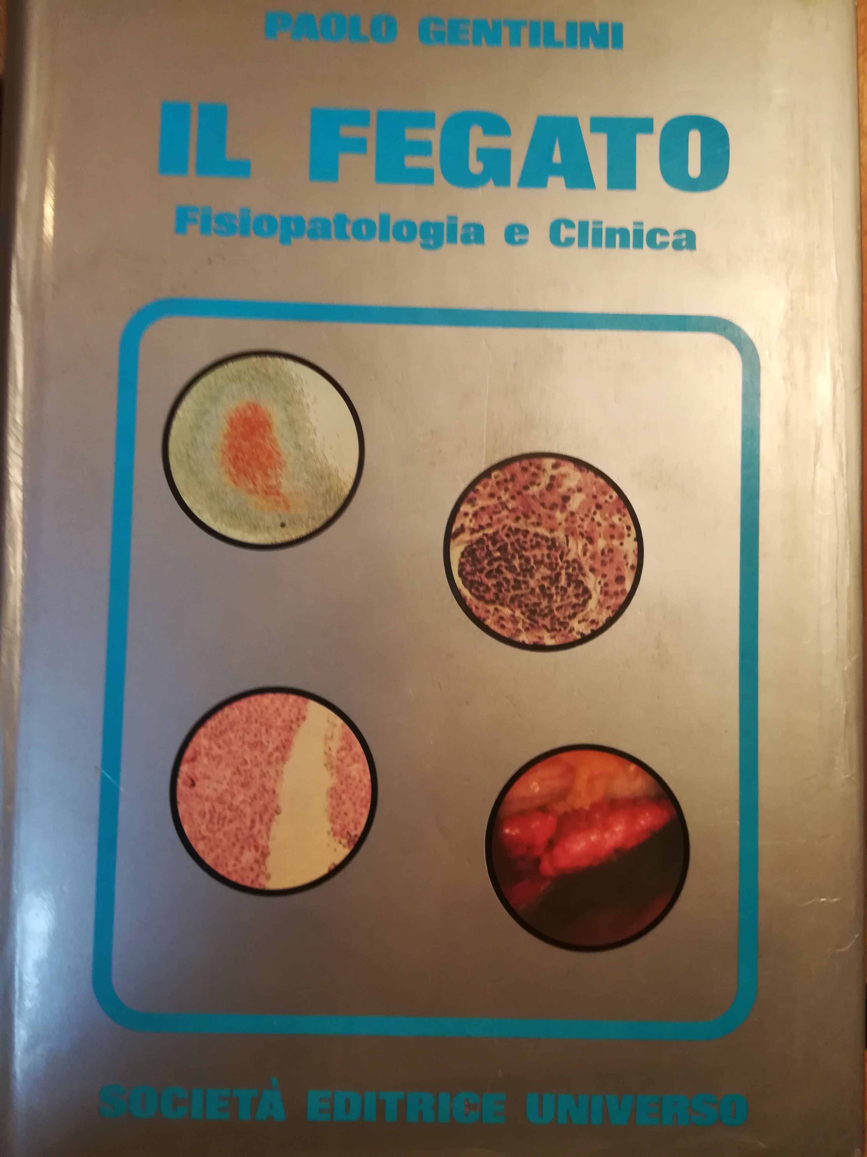 Il fegato. Fisiopatologia e clinica.