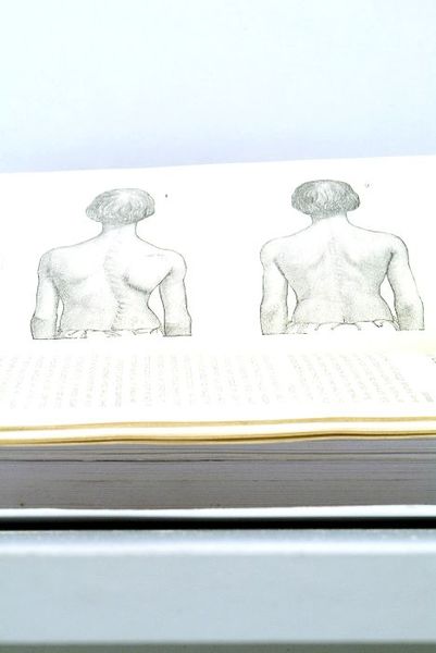 Traitement des Déviations de la Taille sans Appareils. Faits Pratiques.