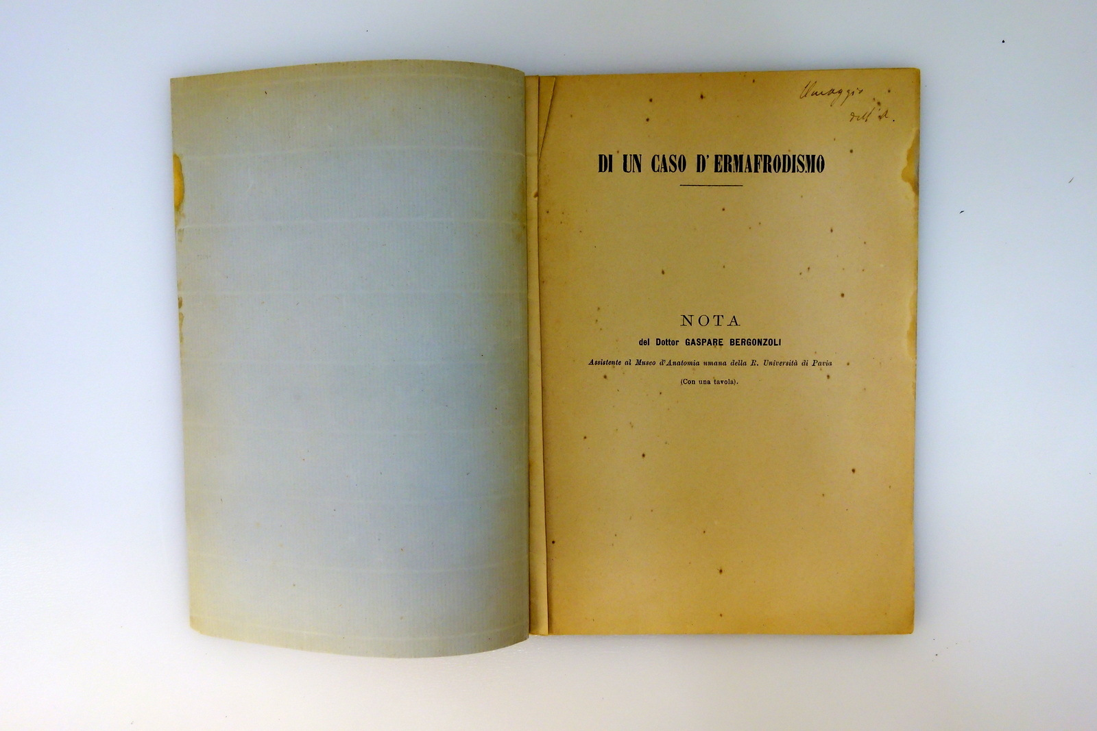 Di un Caso di Ermafroditismo Gaspare Bergonzoli Pavia 1893 con …