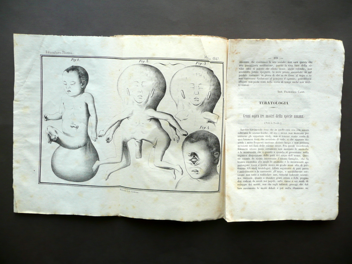 Teratologia Tre Mostri della Specie Umana Gaddi Tavola L'Educatore Storico …