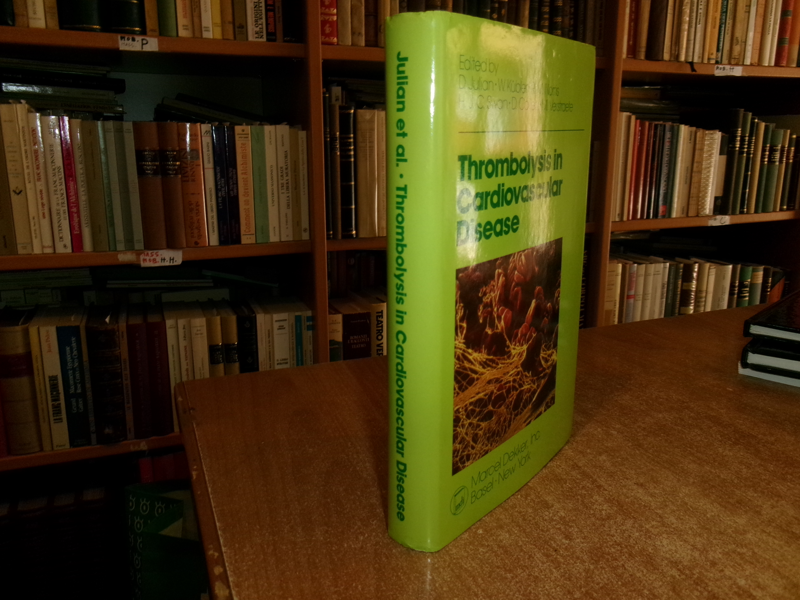 AA. VV. Thrombolysis in Cardiovascular Disease First Edition Edición 1989
