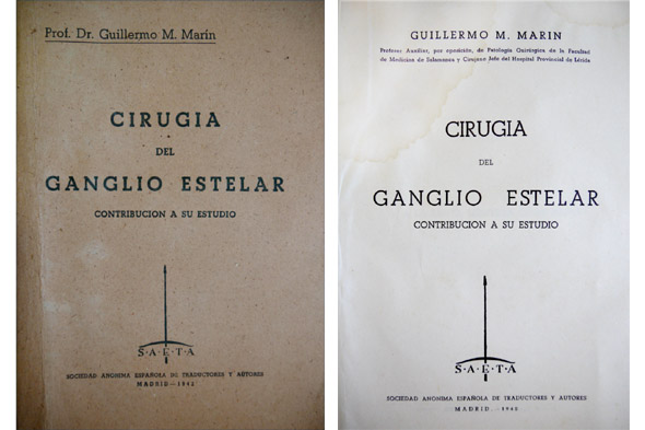 Cirugía del ganglio estelar. Contribución a su estudio.