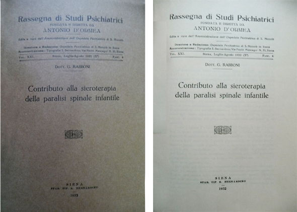 Contributo alla sieroterapia della paralisi spinale infantile.