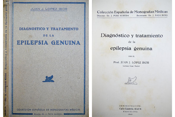 Diagnóstico y Tratamiento de la Epilepsia Genuina.