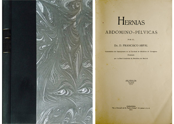 Hernias abdómico-pélvicas.