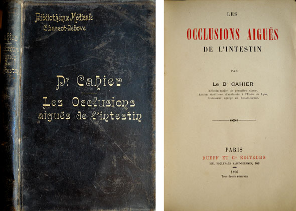 Les Occlusions Aiguës de l'Intestin.
