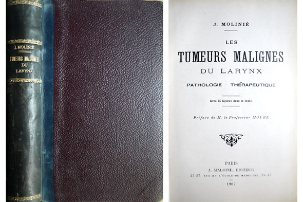 Les Tumeurs Malignes du Larynx. Pathologie. Thérapeutique. Préface de E.- …