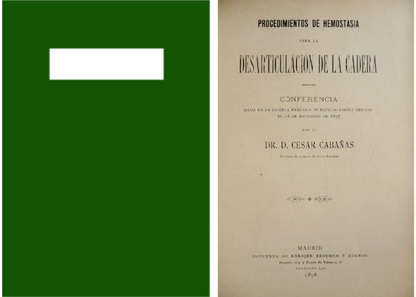 Procedimientos de hemostasia para la desarticulación de la cadera. Conferencia …
