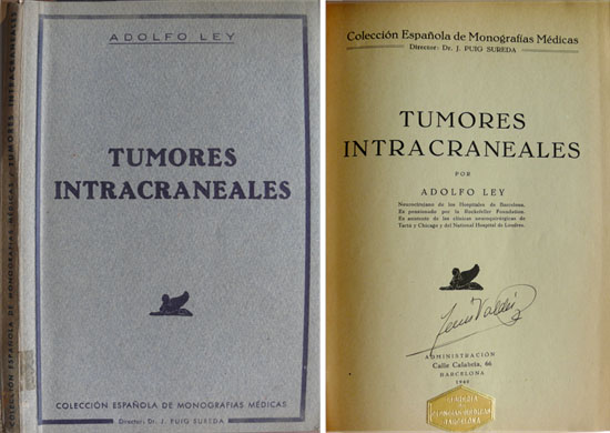 Tumores intracraneales.