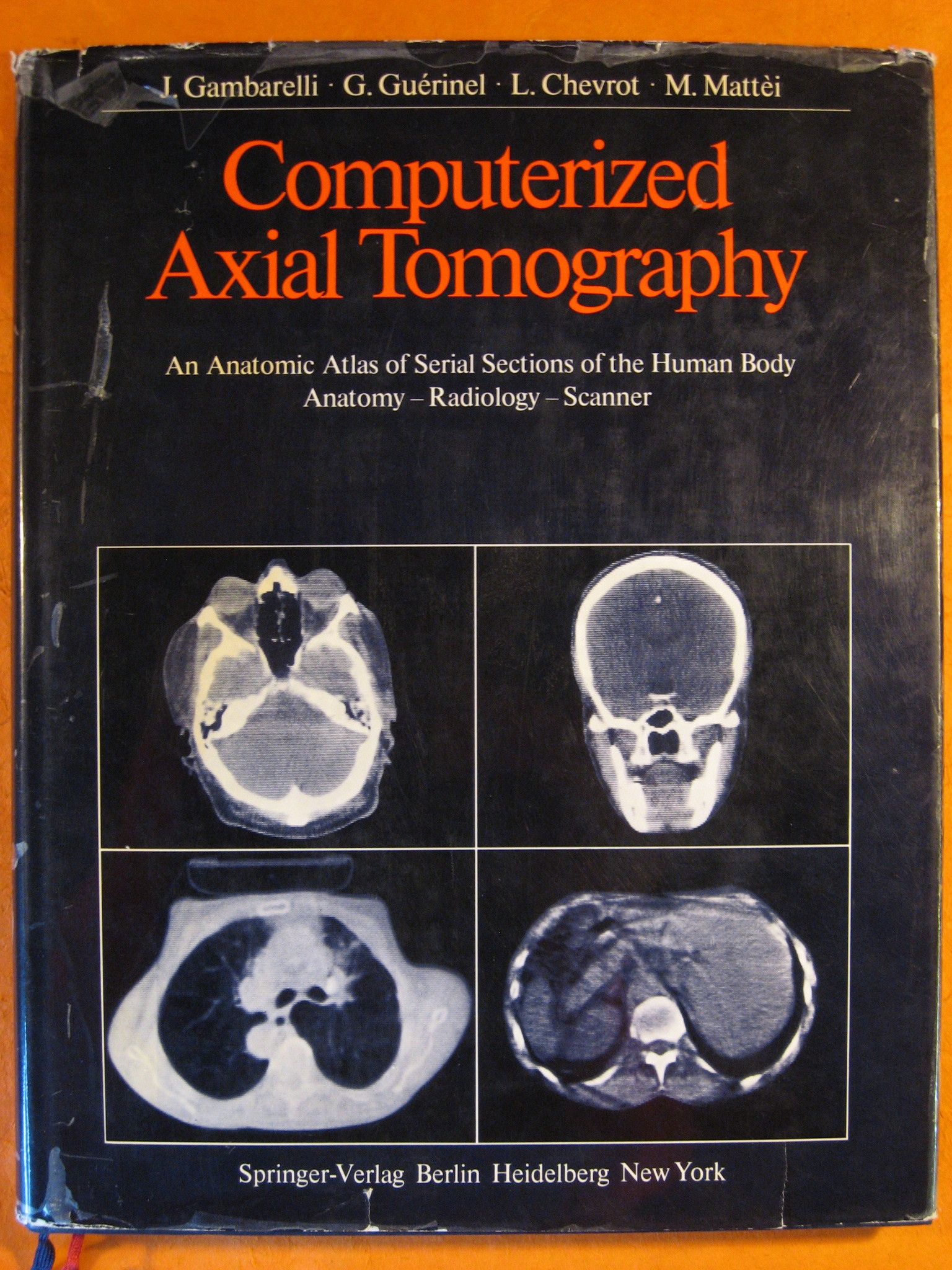 Computerized Axial Tomography: An Anatomic Atlas of Serial Sections of …