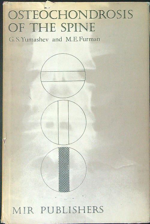 Osteochondrosis of the spine