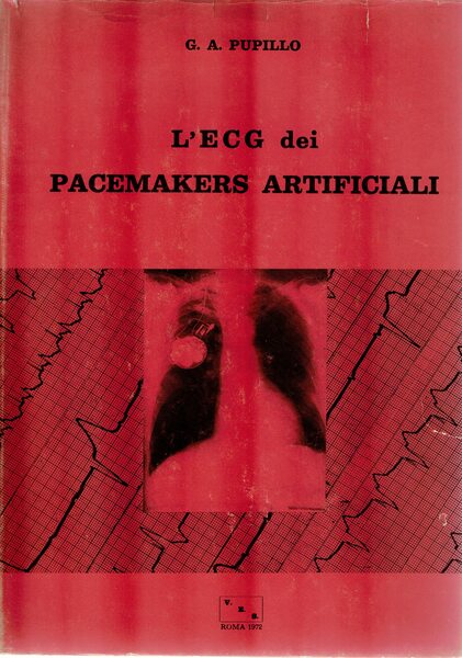 L'ECG dei pacemakers artificiali