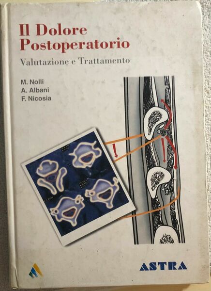 Il dolore postoperatorio di Nolli-albani-nicosia, 1996, Astra