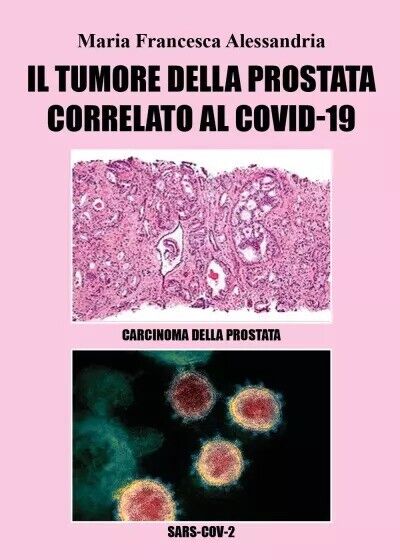 Il tumore alla prostata correlato al Covid-19 di Maria Francesca …