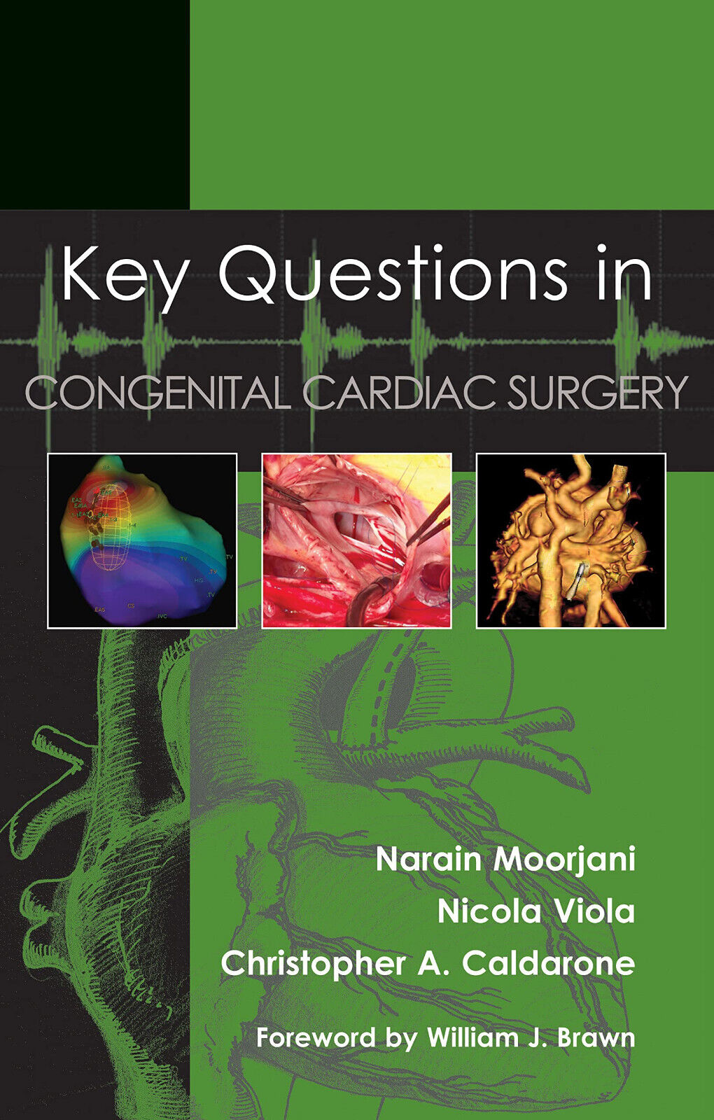 Key Questions in Congenital Cardiac Surgery - TFM, 2022