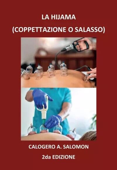 La Hijama 2da. Edizione di Calogero A. Salomon, 2022, Youcanprint