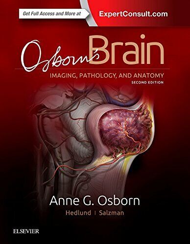 Osborn's Brain - Anne G. Osborn, Gary L. Hedlund, Karen …