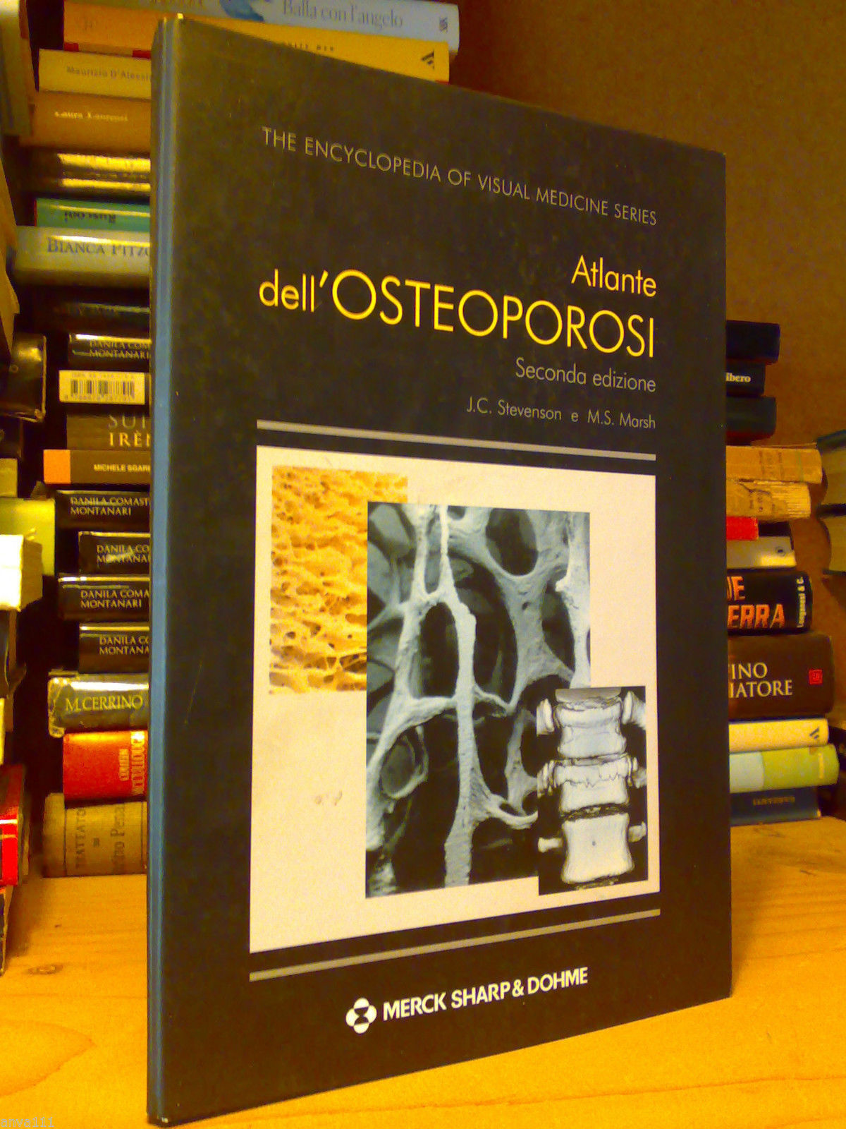 ATLANTE DELL' OSTEOPOROSI - 2 libretti in cofanetto - 2001