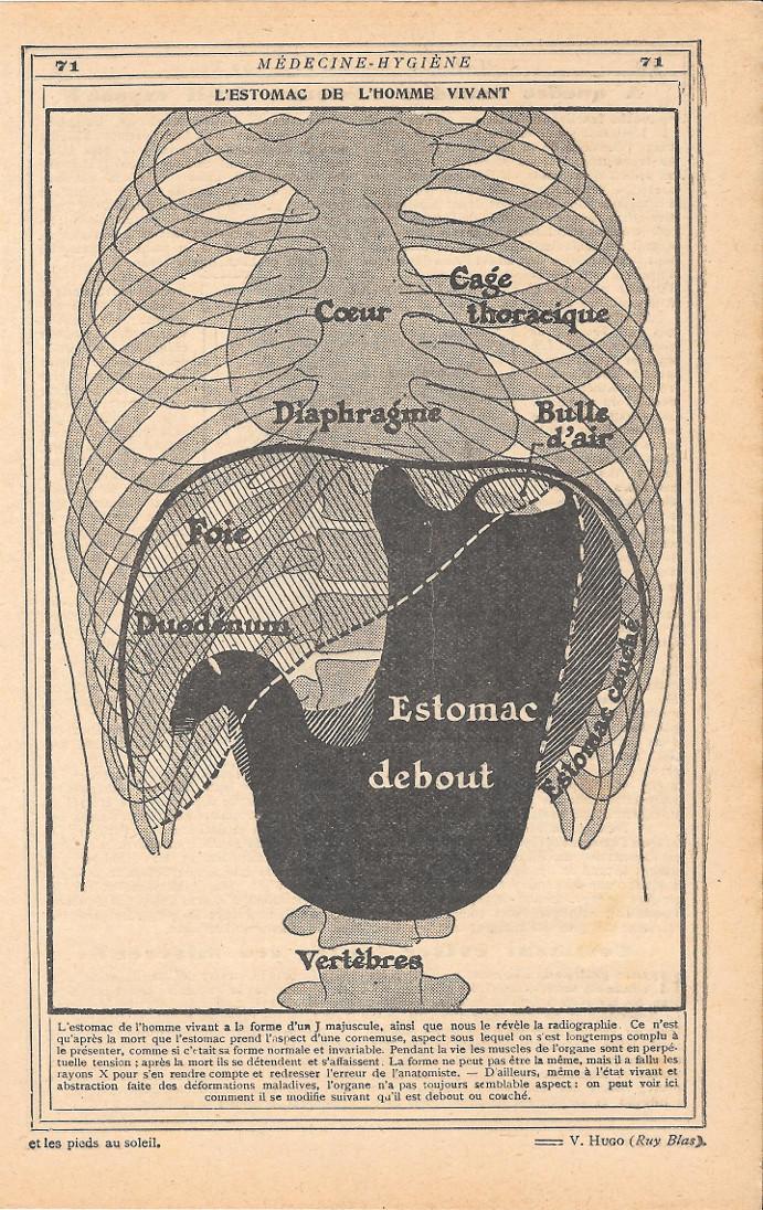 L'estomac de l'homme vivant. Stampa 1923