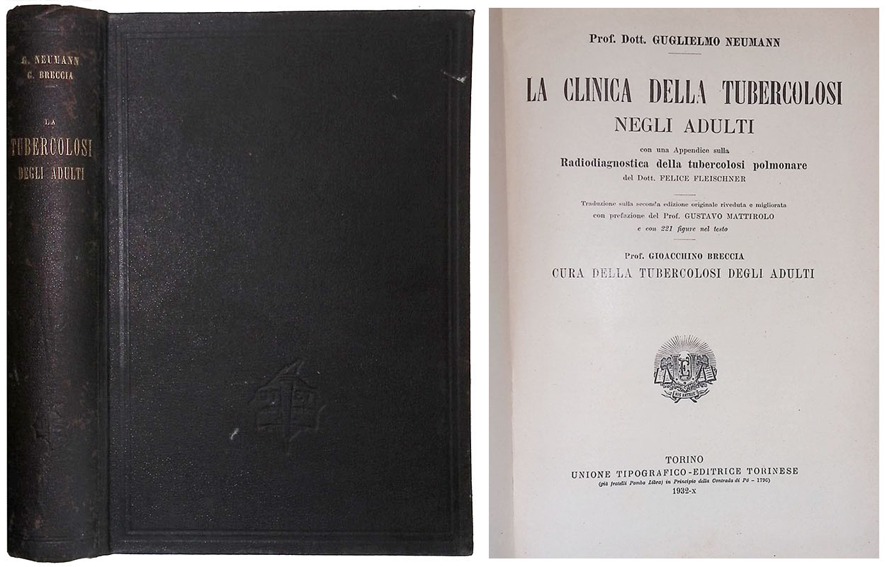 La clinica della tubercolosi negli adulti. Con una Appendice sulla …