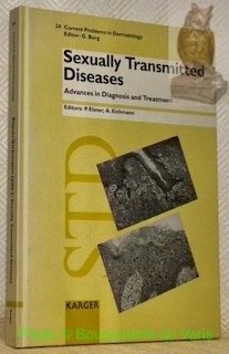 Sexually Transmitted Diseases. Advances in Diagnosis and Treatment. 34 Figures, …