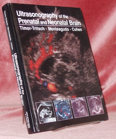 Ultrasonography of the Prenatal and Neonatal Brain.
