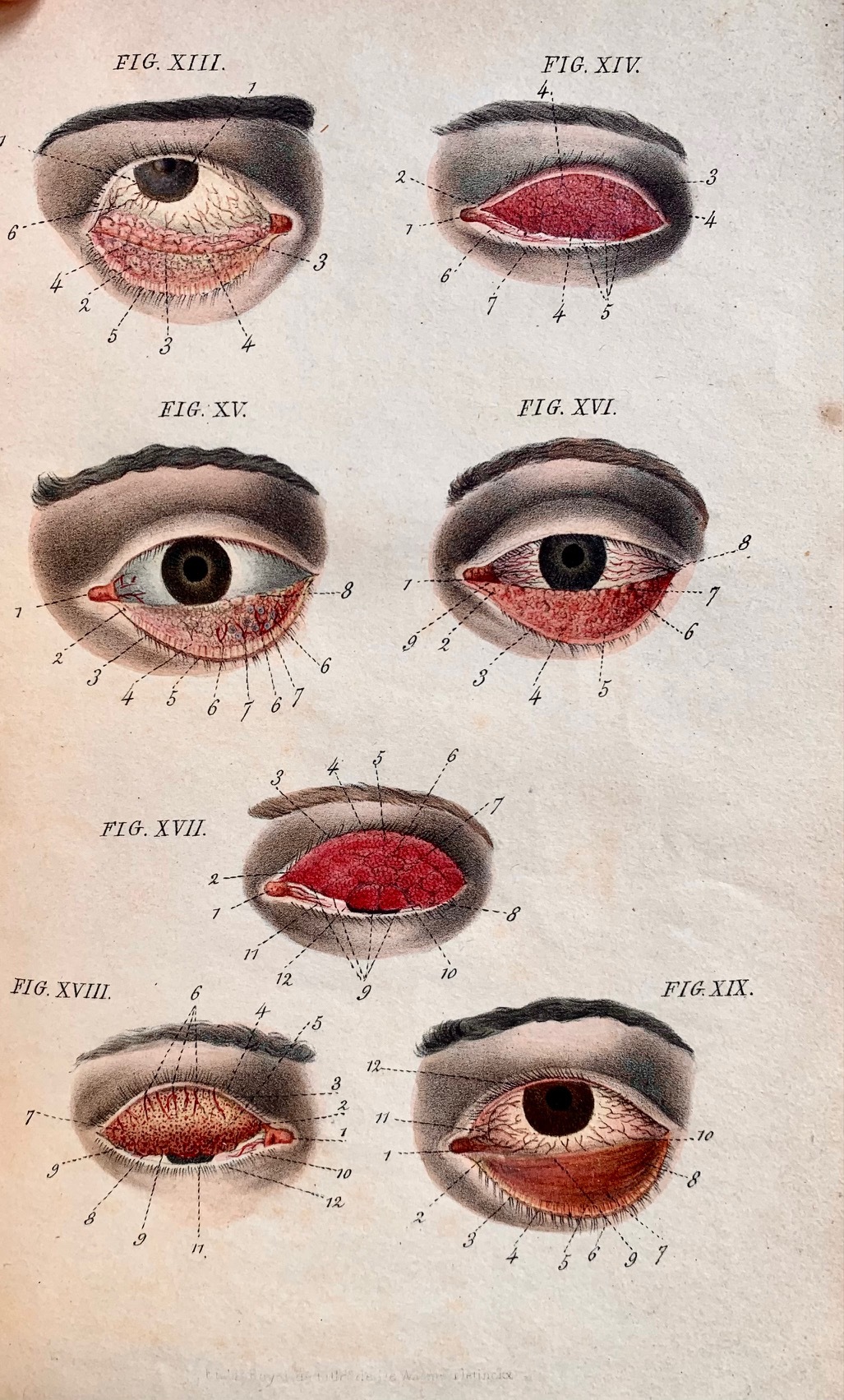 De la structure des maladies de la conjonctive, avec des …