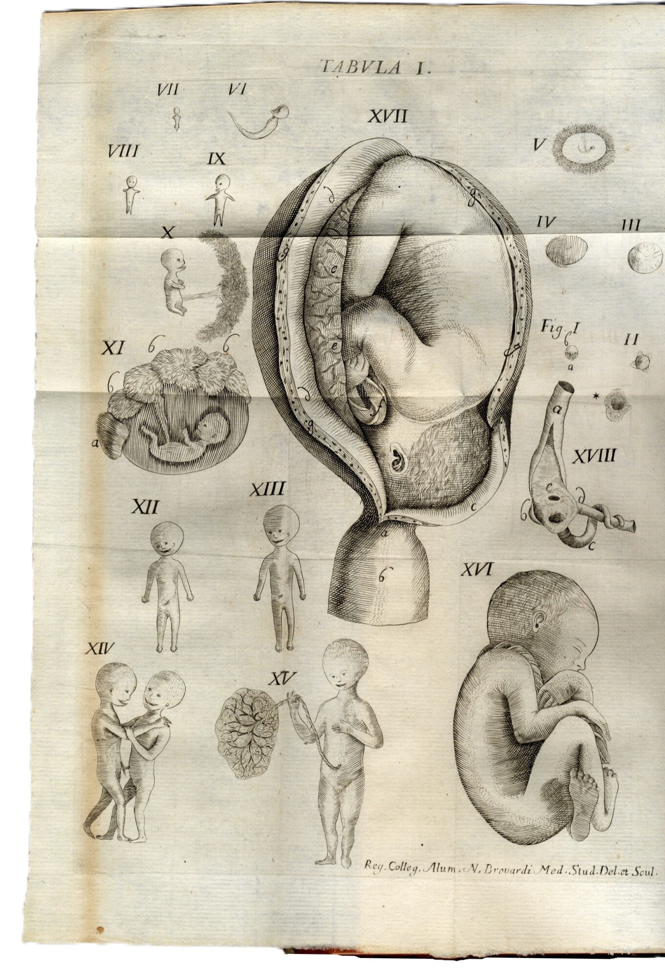 De Naturali in Humano Corpore, vitiosa morbosaque generatione historia...