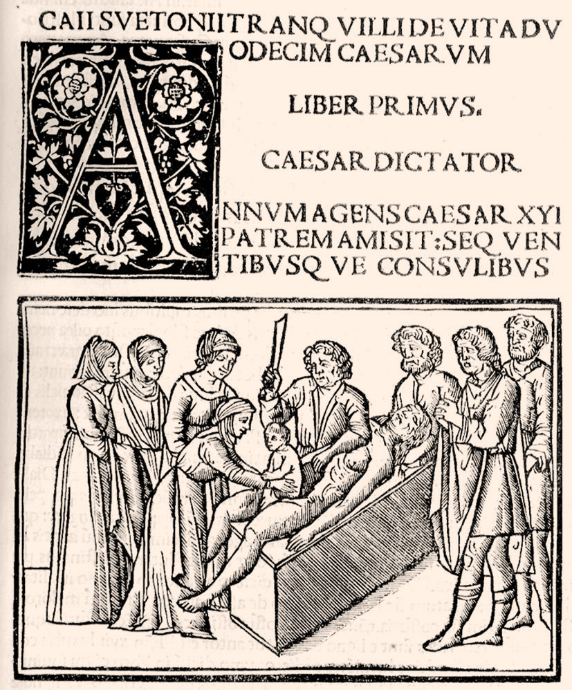 De Vita XII Caesarum. Cum Philippi Beroaldi et Marci Antonii …