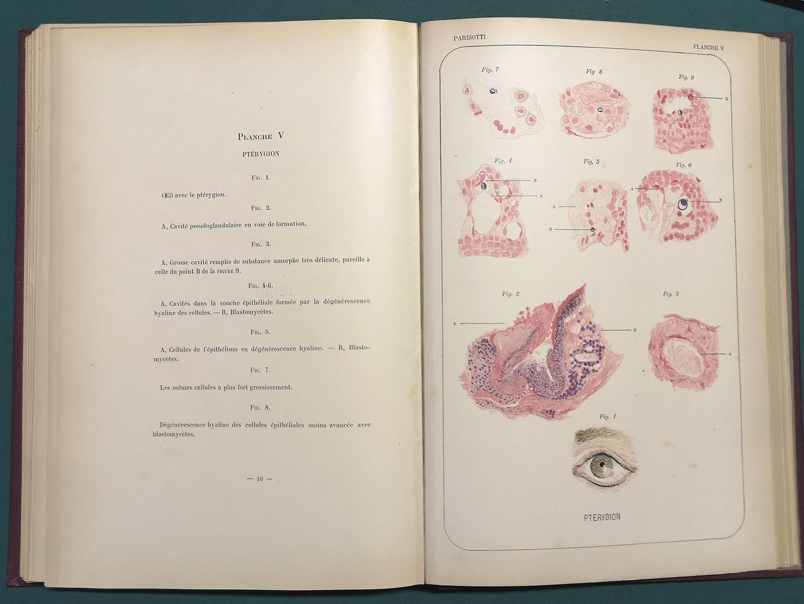 Histologie pathologique de l'oeil. Avec 20 planches dessinées d'après nature.