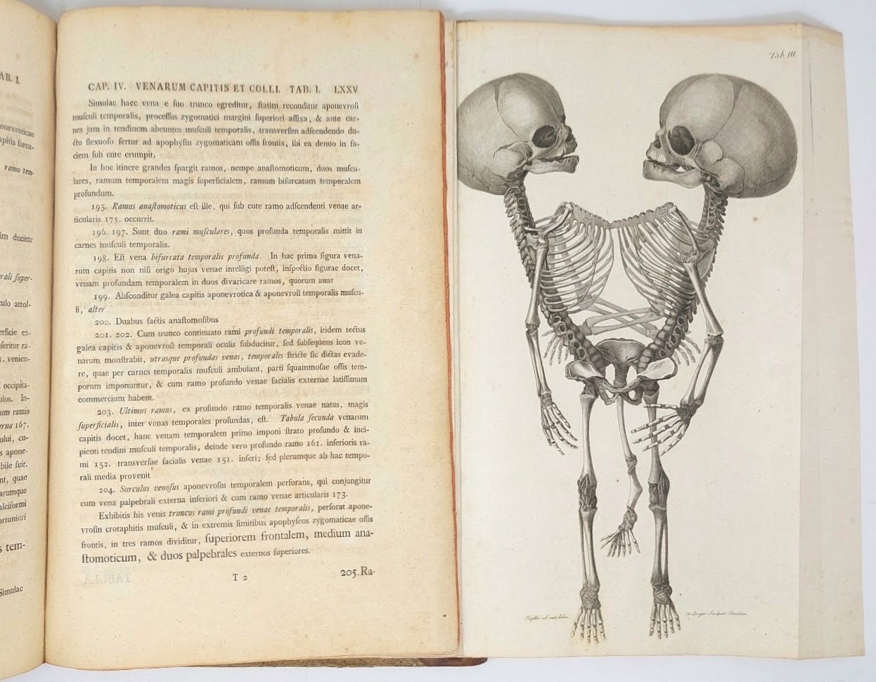 Observationes Anatomicae. Historia Monstri bicorporis duobus capitibus, tribus pedibus, pectore …