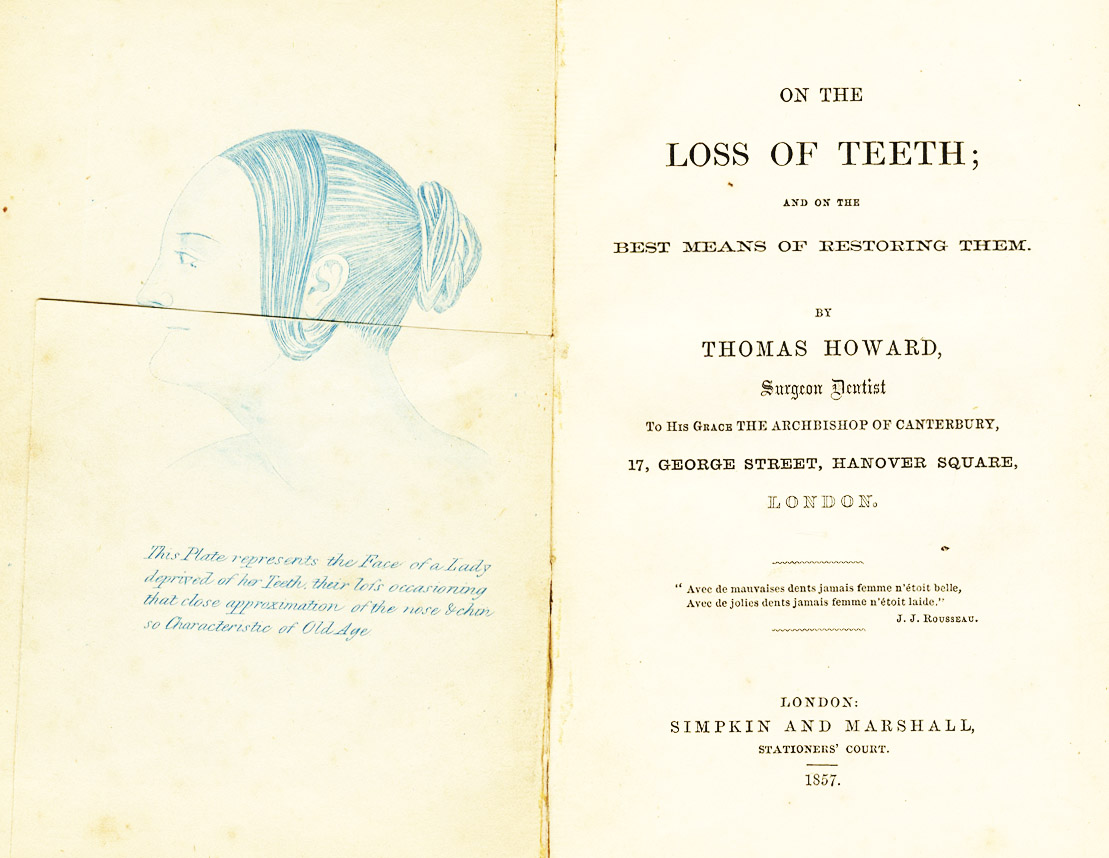 On the loss of teeth and on the best means …