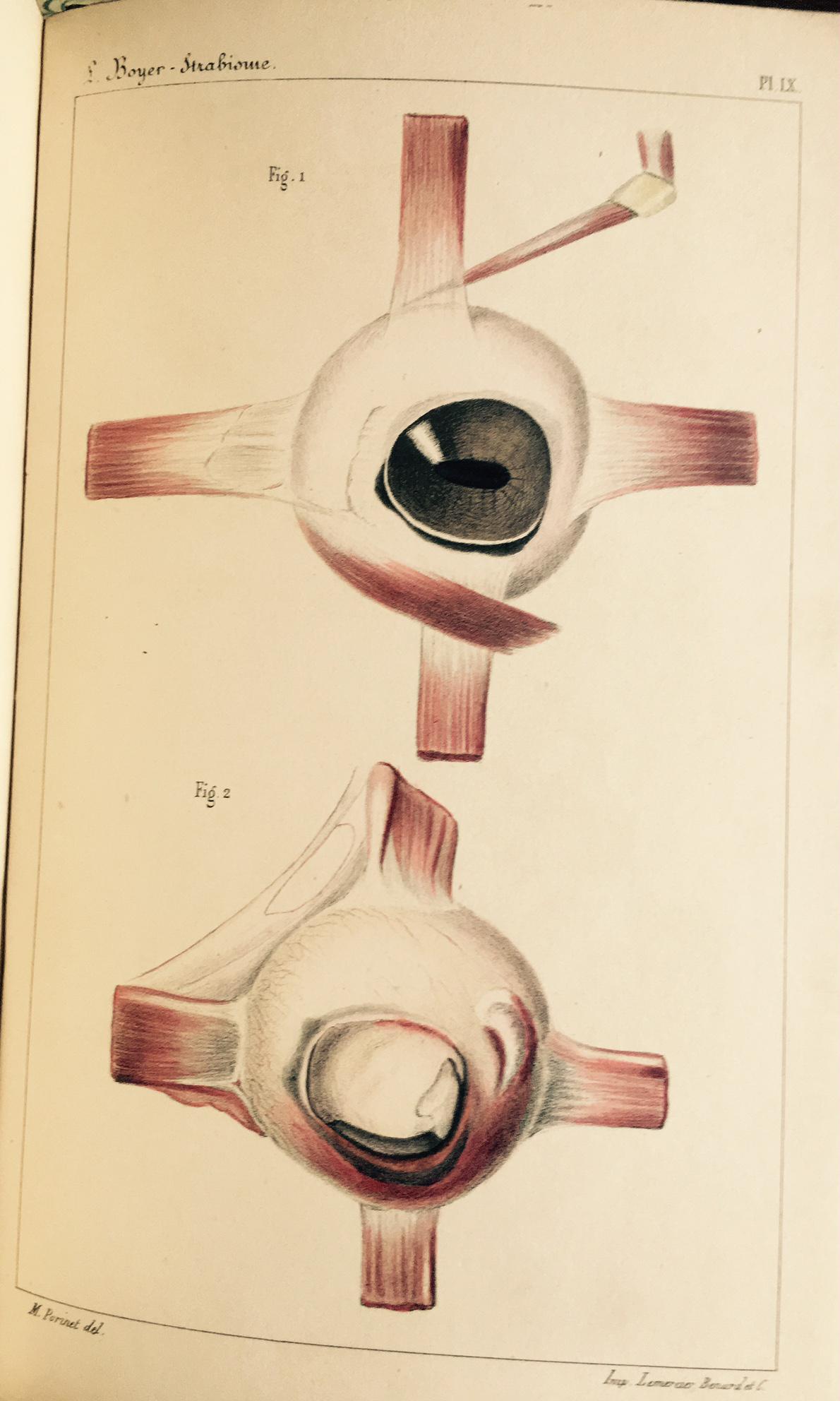 Recherches sur L'opération du strabisme. Mémoire présenté a l'Académie Royale …