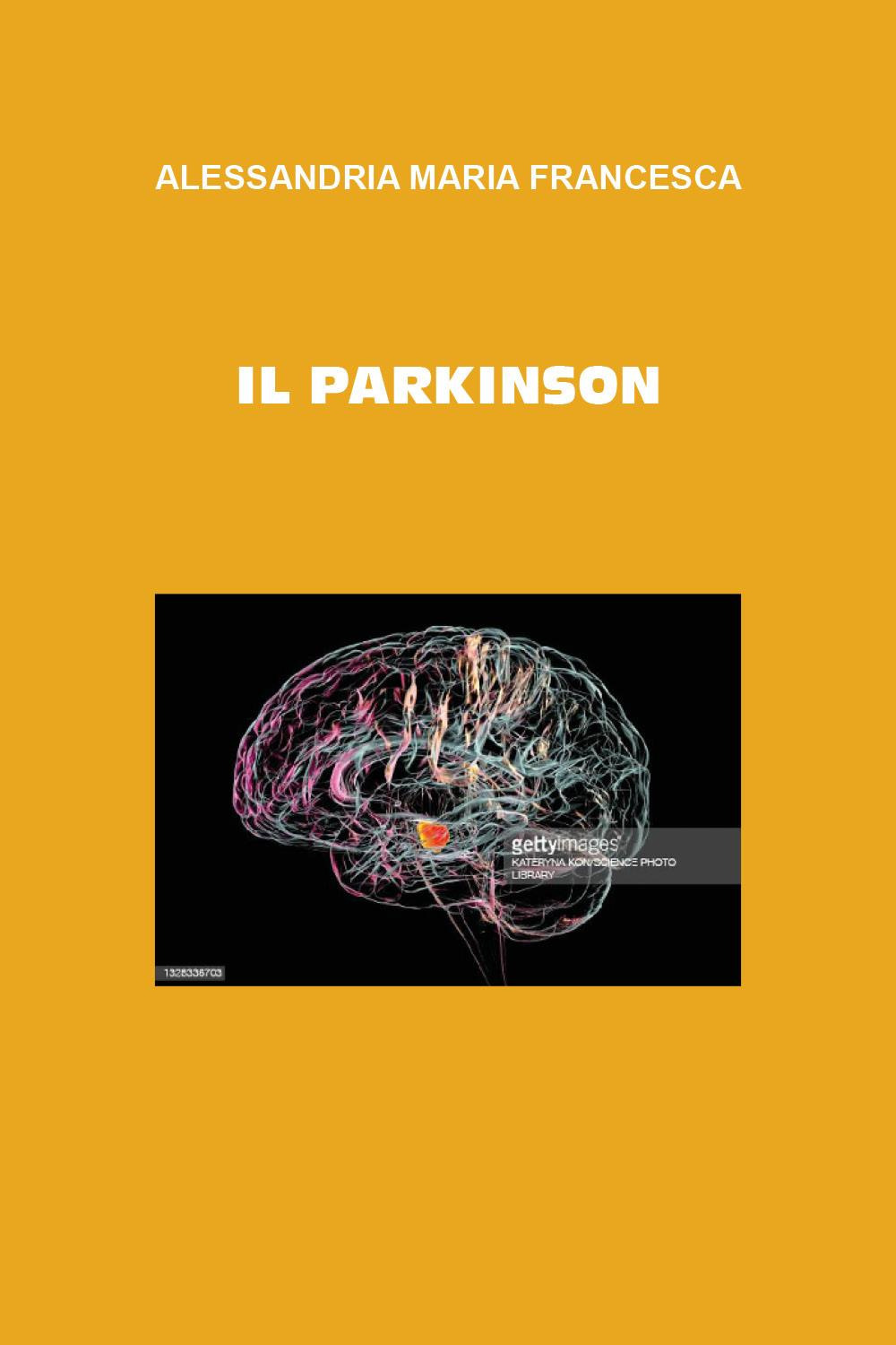 Il Parkinson