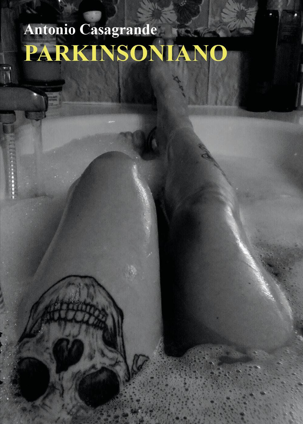 Parkinsoniano