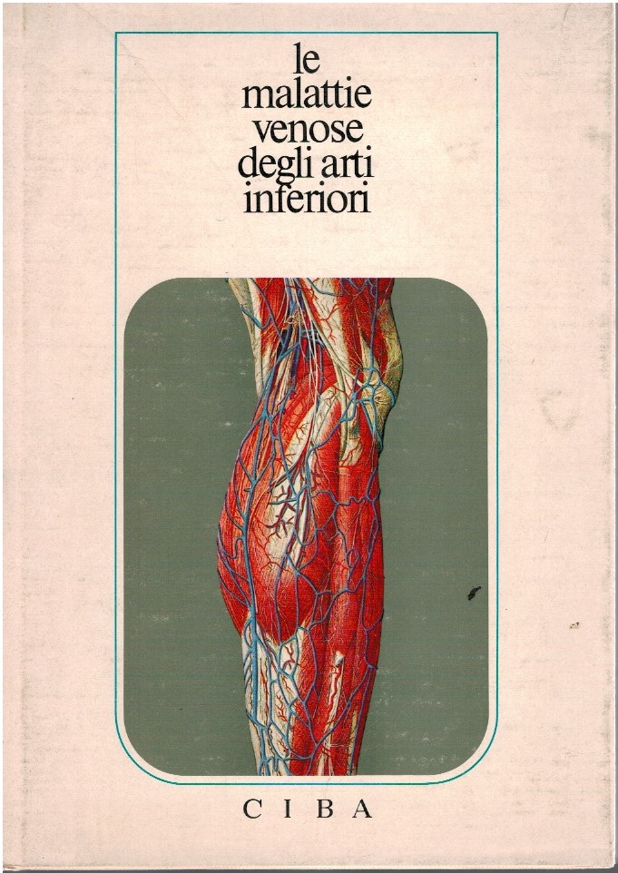 Le malattie venose degli arti inferiori