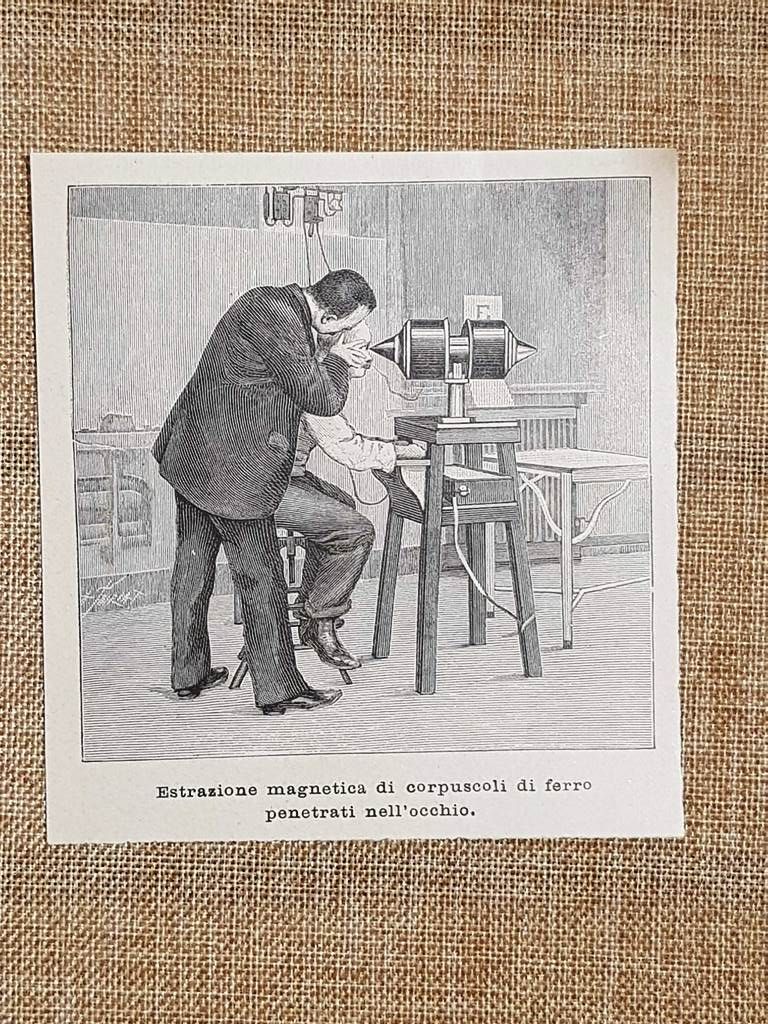 Strumento per estrarre corpuscoli ferro dall'occhio Stampa del 1896 Invenzione