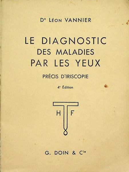 Le diagnostic des maladies par les yeux