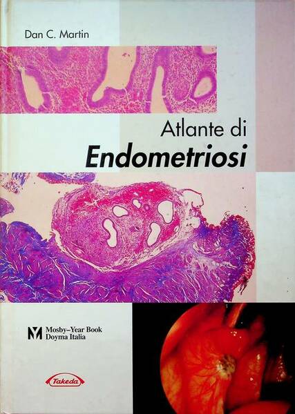 Atlante di endometriosi.