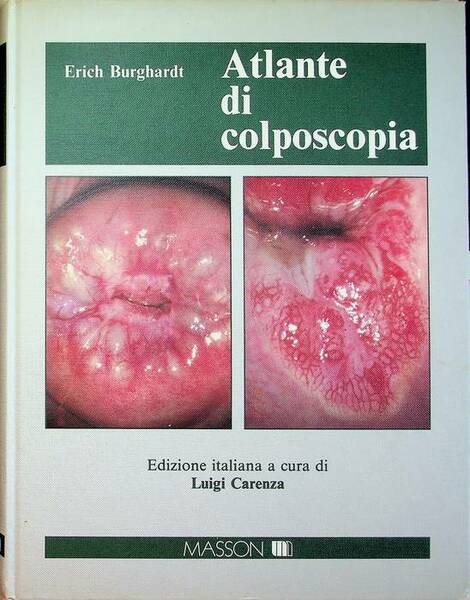 Atlante di colposcopia.