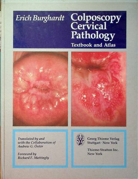 Colposcopy, cervical pathology: textbook and atlas.