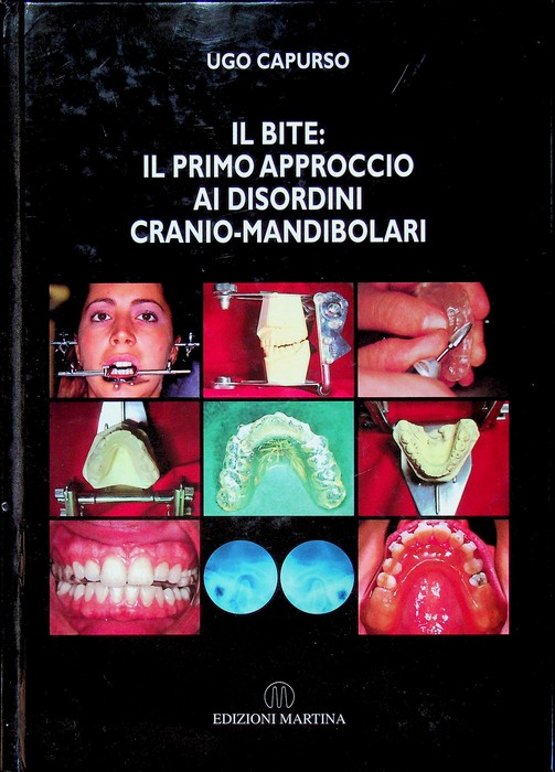 Il bite: primo approccio ai disordini cranio-mandibolari.
