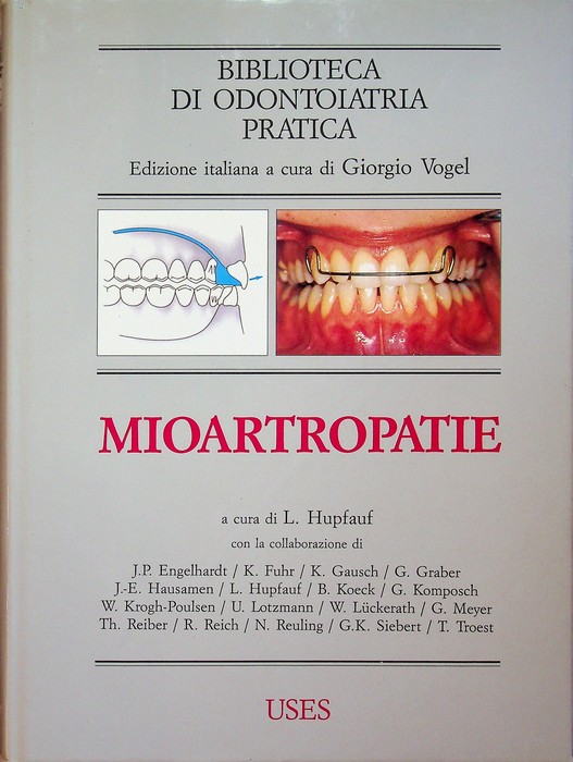 Mioartropatie.