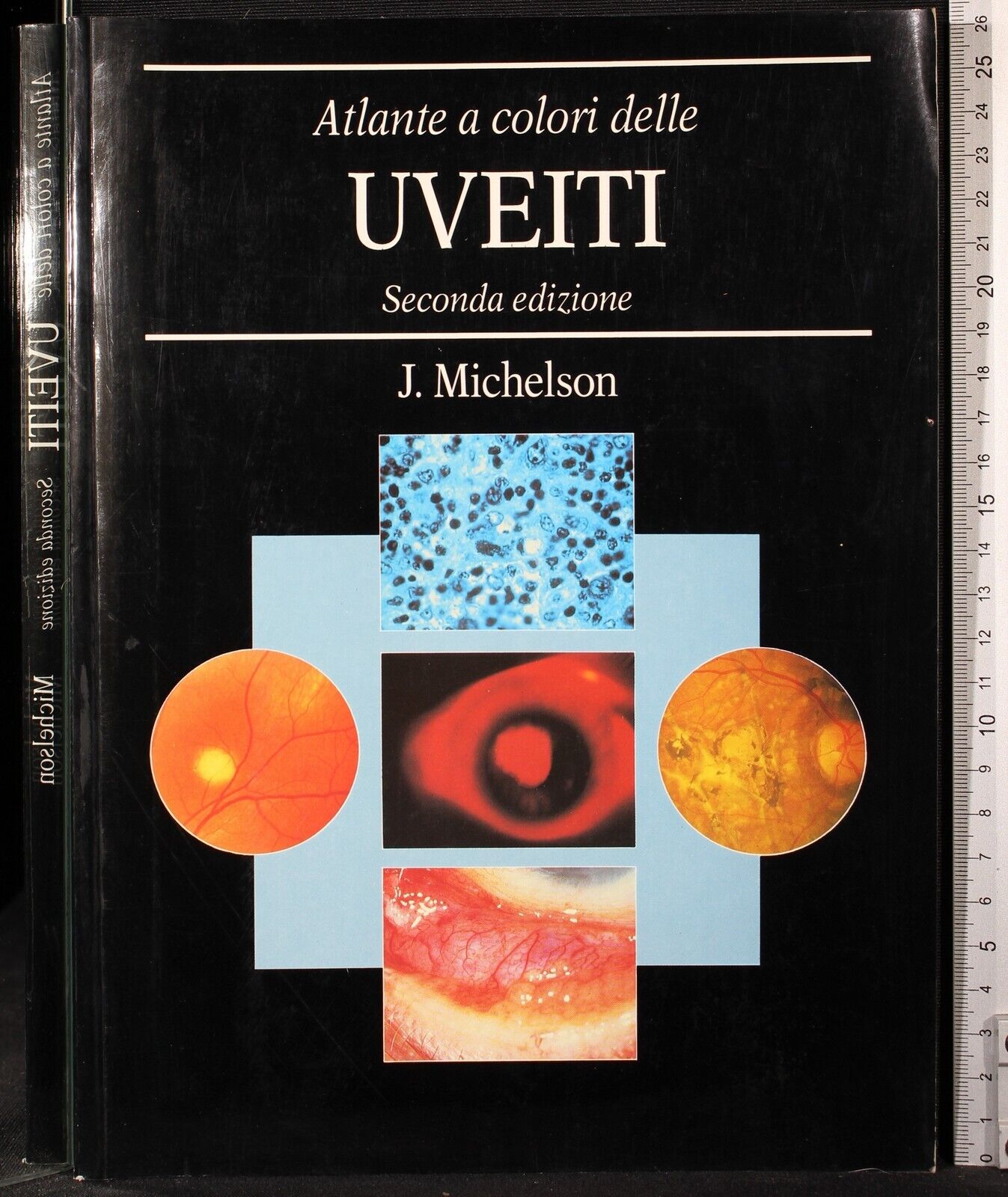 Atlante a colori delle uveiti
