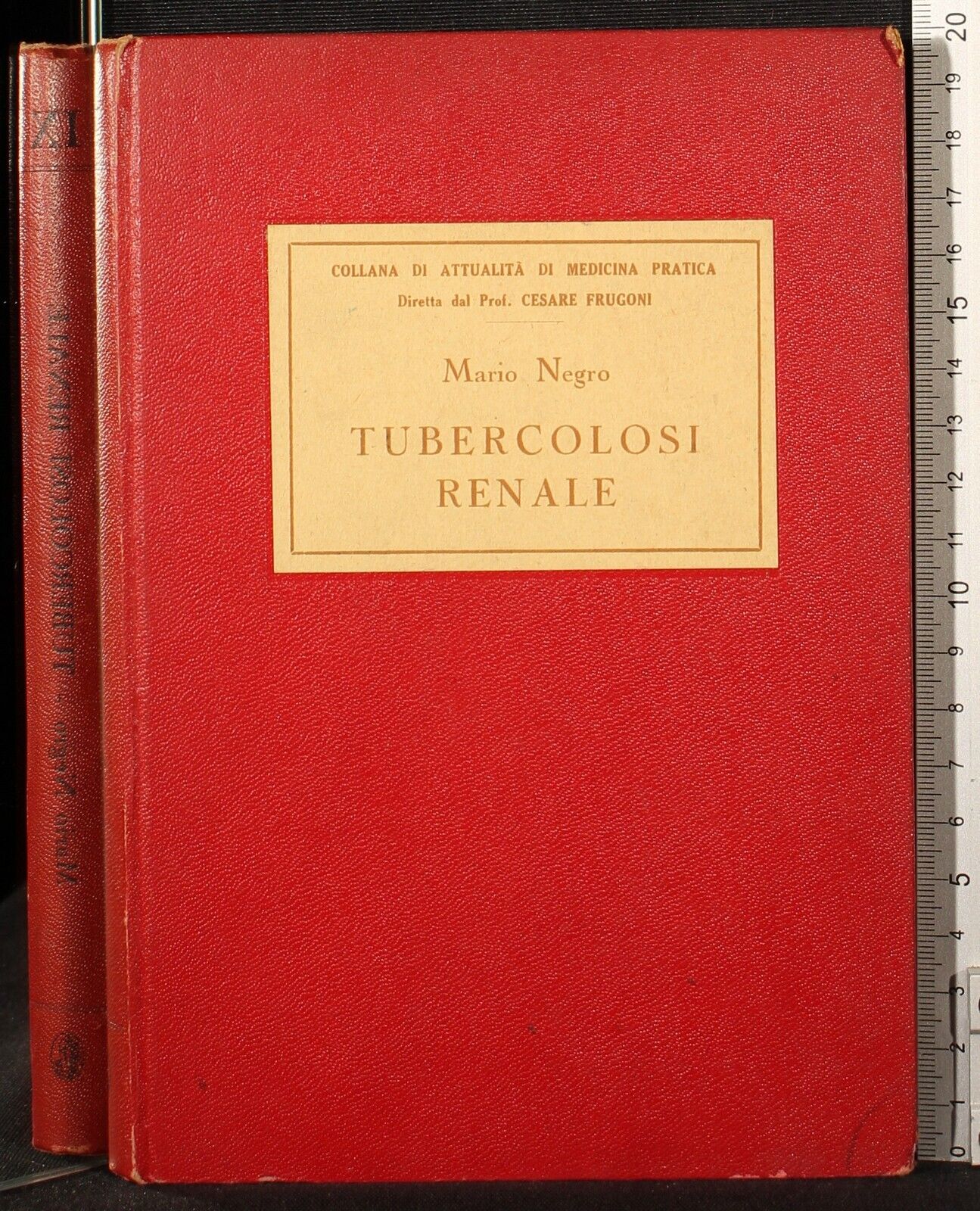 Tubercolosi renale