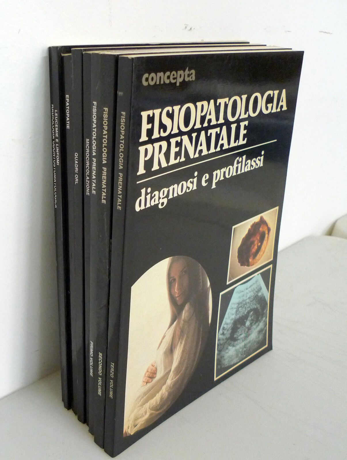 Lotto 8 vol.CONCEPTA,Angelini 1974[medicina,LEUCEMIE,FISIOPATOLOGIA PRENATALE