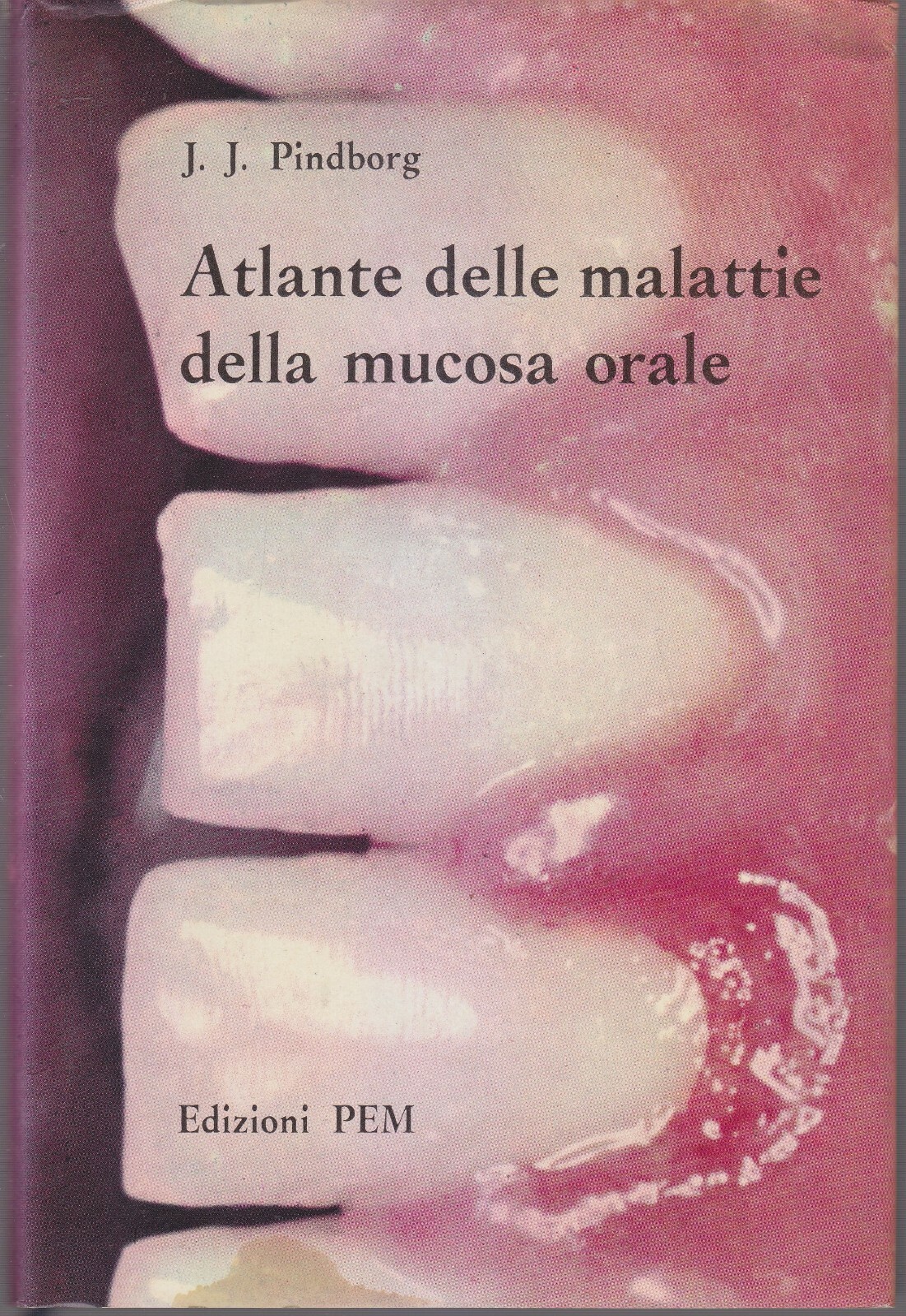 ATLANTE DELLE MALATTIE DELLA MUCOSA ORALE di Pindborg 1968 PEM …