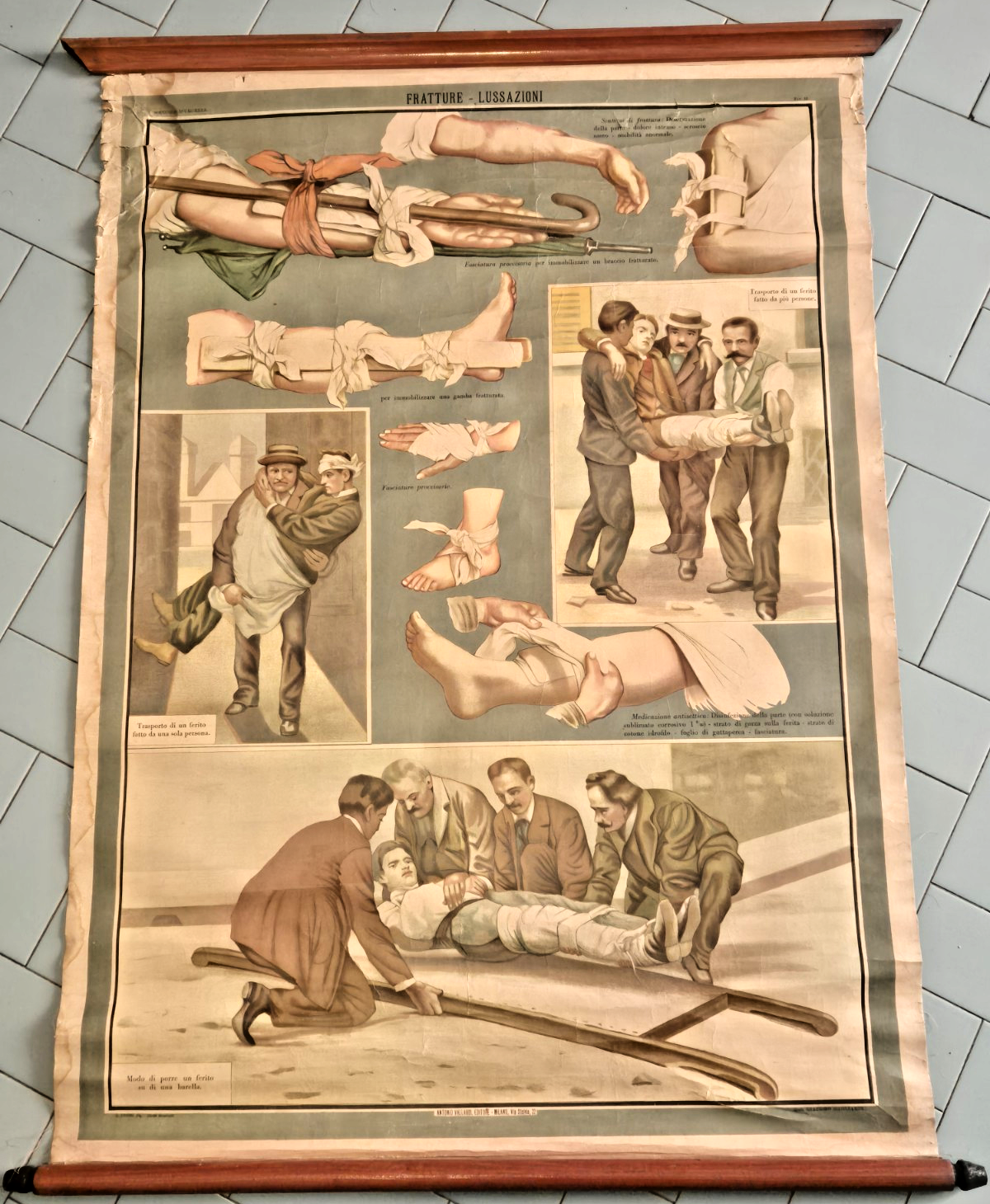 POSTER DIDATTICO SCOLASTICO Antico anni '20 Fratture Lussazioni Tavola Vallardi